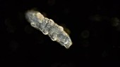 Water bear, light microscopy