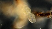 Stylonychia protozoan dividing