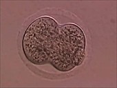 Developing human embryo, microscope view