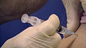 Pneumovax vaccination