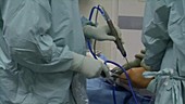 Knee arthroscopy