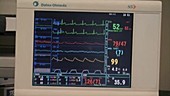 Surgical monitor display screen