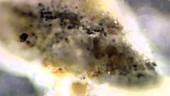 Chewing gum lichen, light microscopy