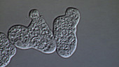 Entamoeba histolytica parasites