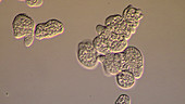 Entamoeba histolytica parasites