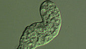 Entamoeba histolytica parasite