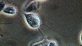 Trichomonas vaginalis parasites
