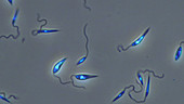 Leishmania major parasites