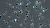 Leishmania aethiopica parasites
