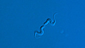 Trypanosoma brucei parasites