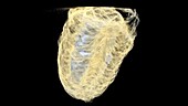 Chinese mantis egg mass, CT scan