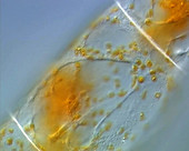 Pumpkin cell, light micrograph