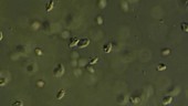 Ciliate protozoa swimming