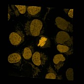 Cell during metaphase, microscopy