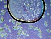 Colpidium protozoa