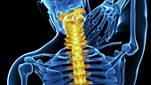 Human neck pain