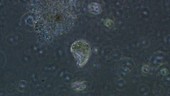 Ciliate protozoan swimming