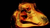 Human foetus, 3D animation