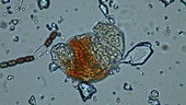 Rotifer in meltwater, light microscopy