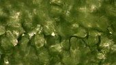 Plant cells, light microscopy