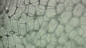 Bladderwort trap, light microscopy