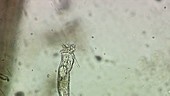 Rotifer, light microscopy