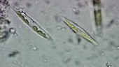 Diatoms, light microscopy