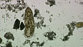 Protozoan, light microscopy