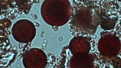 Pigmented ice microbes, light microscopy