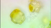 Pollen grains, light microscopy