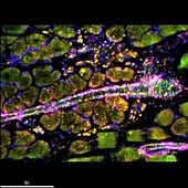 Blood vessel, fluorescence microscopy