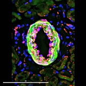 Artery, fluorescence microscopy