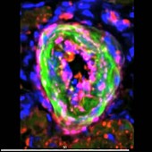 Artery, fluorescence microscopy