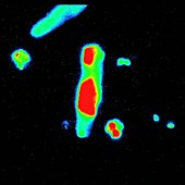 Heart cell, fluorescence microscopy