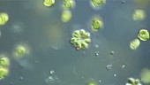 Synura golden algae
