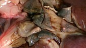Liver flukes in sheep liver