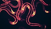 Nematode worms, fluorescent microscopy