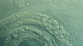 Nematode worms, fluorescent microscopy