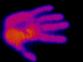 Hand print, thermogram footage