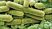 Clostridium difficile bacteria, SEM