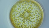 Coscinodiscus diatom, light microscopy