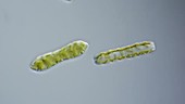 Cymatopleura diatoms, light microscopy