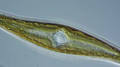 Gyrosigma diatom, light microscopy