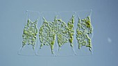 Mediopyxis diatoms, light microscopy