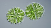 Micrasterias algal cells, light microscopy