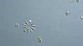 Mesodinium protozoan, light microscopy