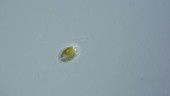 Mallomonas algal cell, light microscopy