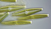 Navicula diatoms, light microscopy
