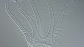 Stephanoceros rotifer, light microscopy