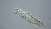 Tintinnopsis ciliate, light microscopy